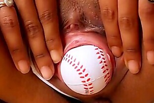 Gaping